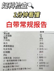白带常规多久复查一次-两性知识丨两性健康--你想了解的我都知道