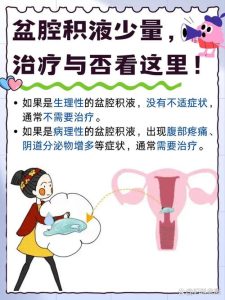 盆腔积液需要治疗吗-两性知识丨两性健康--你想了解的我都知道