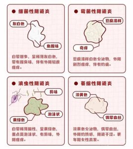 阴道炎治疗后多久复查白带-两性知识丨两性健康--你想了解的我都知道
