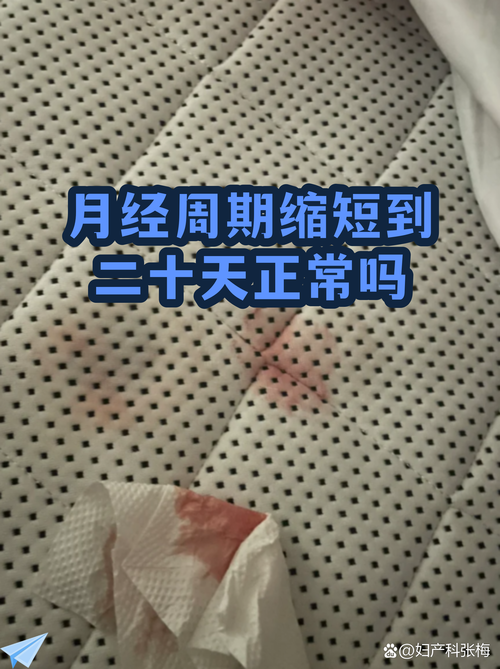月经周期突然缩短到20天要紧吗