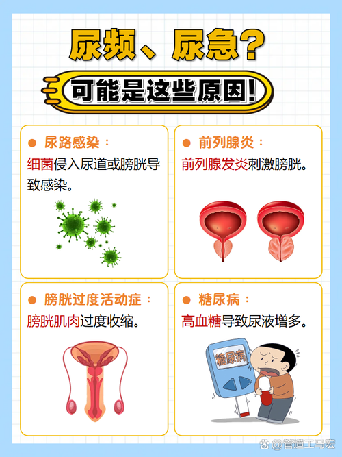 尿频尿急和前列腺有关吗