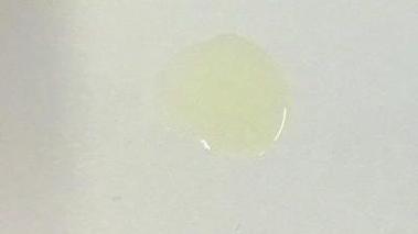 男性尿后有白色分泌物是什么