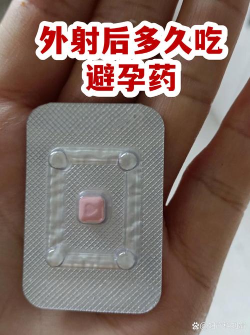 体外射精后要吃紧急避孕药吗