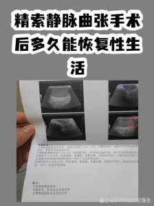 精索静脉曲张手术后还能恢复生育能力吗?-两性知识丨两性健康--你想了解的我都知道