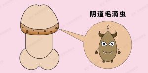 男性感染阴道毛滴虫会有哪些症状?-两性知识丨两性健康--你想了解的我都知道