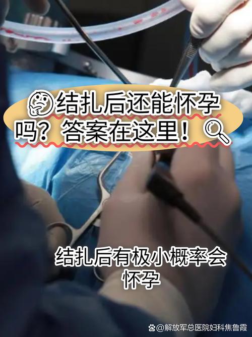 女性结扎后还会怀孕吗