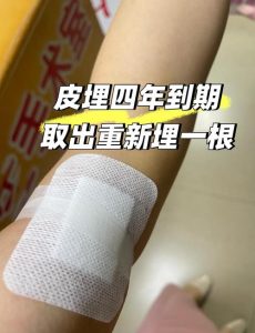 皮下埋植后月经不规律要紧吗-两性知识丨两性健康--你想了解的我都知道