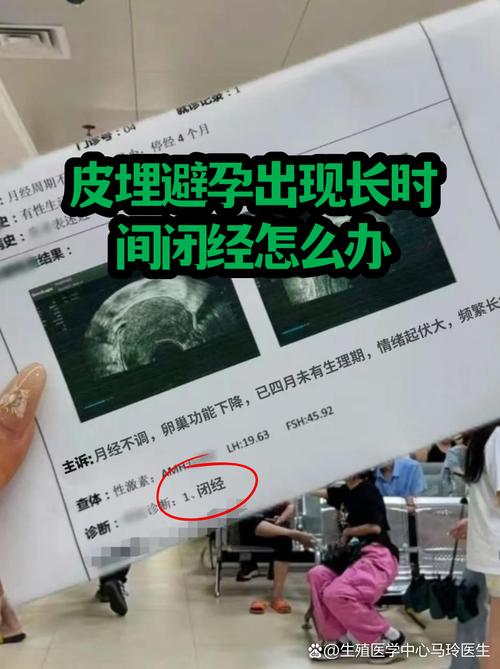 皮下埋植后月经不规律要紧吗
