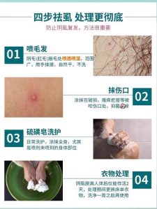 阴虱怎么治才能断根?衣物床单该怎么消毒才彻底?-两性知识丨两性健康--你想了解的我都知道