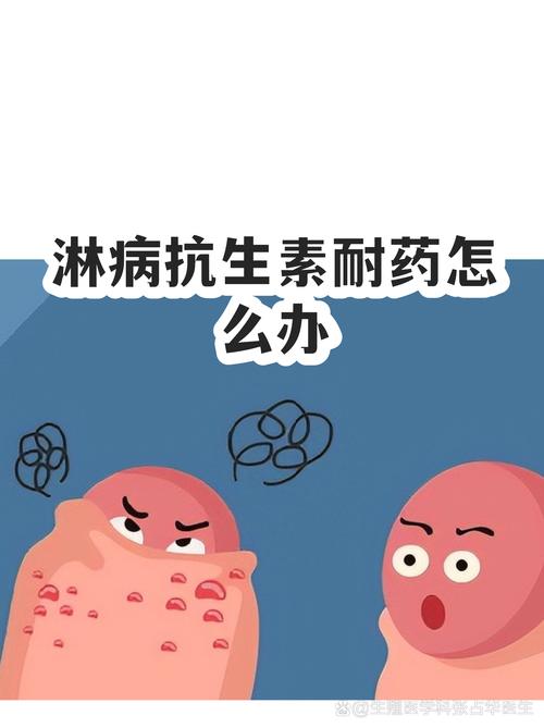 淋球菌耐药会影响治疗吗