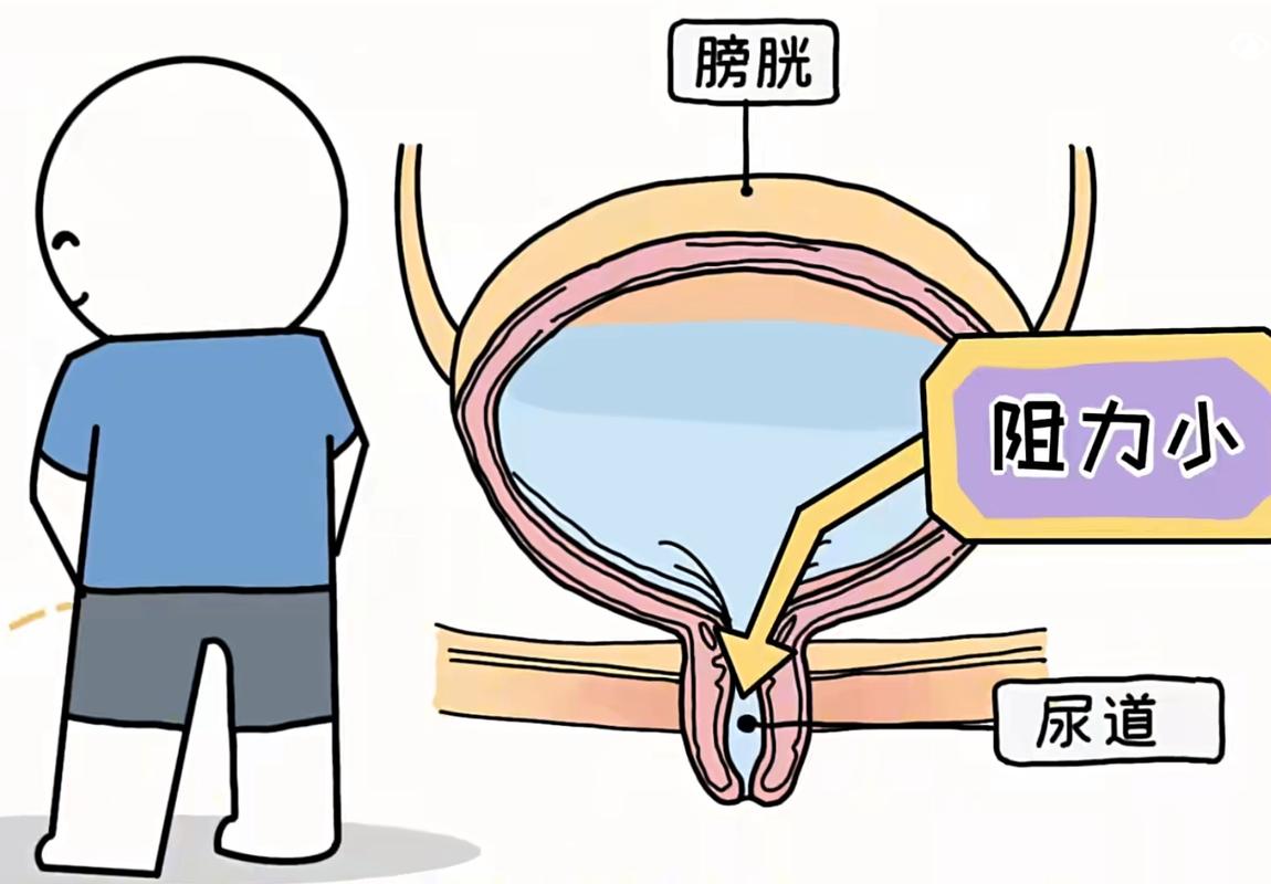 尿得远就代表性功能强吗