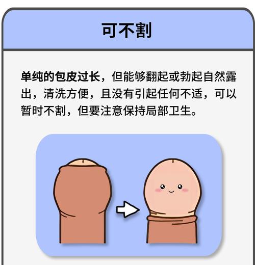 割包皮能让阴茎显得更大吗