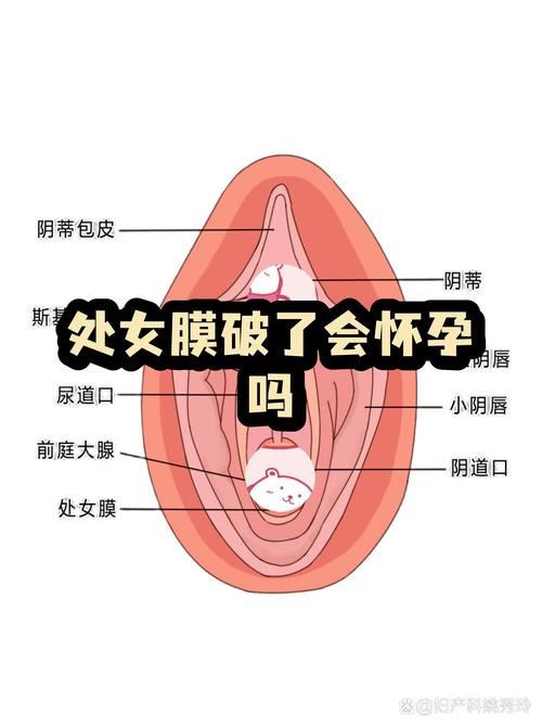 处女膜没破就不会怀孕吗