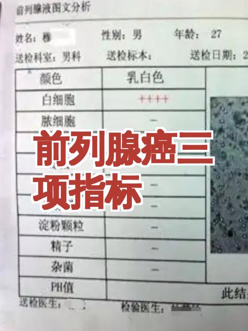 体检报告前列腺指标异常,先挂哪个科