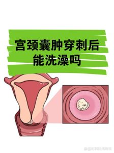 查出内异症囊肿,到底能不能做穿刺?-两性知识丨两性健康--你想了解的我都知道