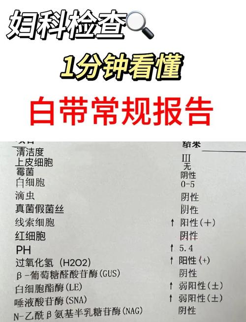 生殖道感染复查要查什么