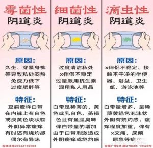 细菌性阴道炎和霉菌性阴道炎，到底哪里不一样？-两性知识丨两性健康--你想了解的我都知道