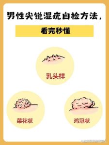 男性乳头有分泌物是病吗?别慌,先看看这几种情况-两性知识丨两性健康--你想了解的我都知道