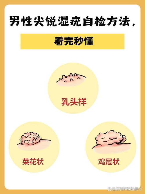 男性乳头有分泌物是病吗
