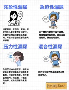 尿失禁有哪几种类型-两性知识丨两性健康--你想了解的我都知道