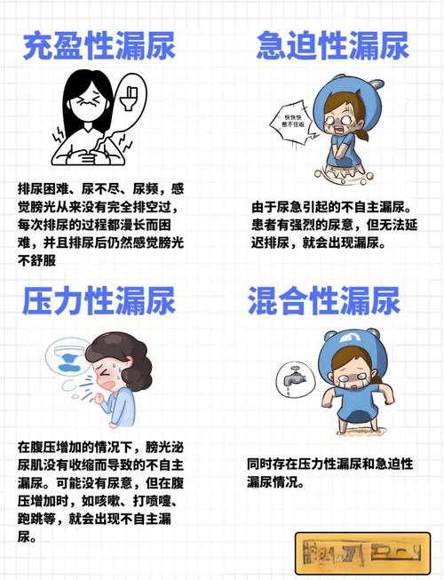 尿失禁有哪几种类型
