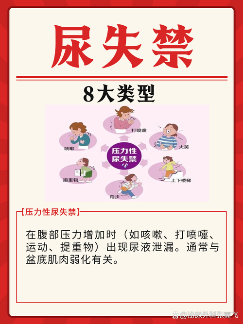 尿失禁有哪几种类型