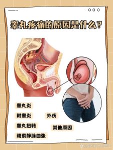 睾丸疼痛可能是什么原因-两性知识丨两性健康--你想了解的我都知道