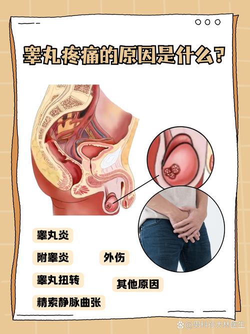 睾丸疼痛可能是什么原因