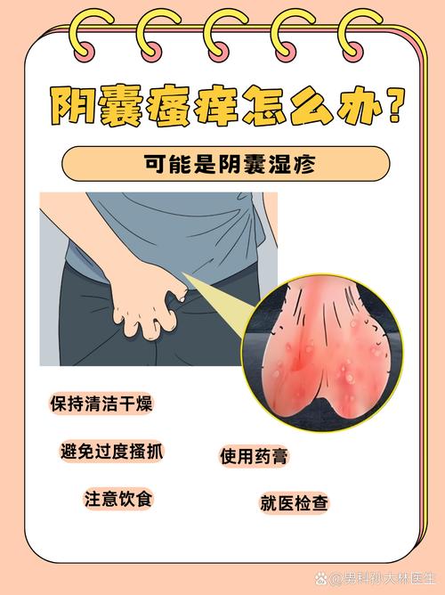 阴囊潮湿是什么原因