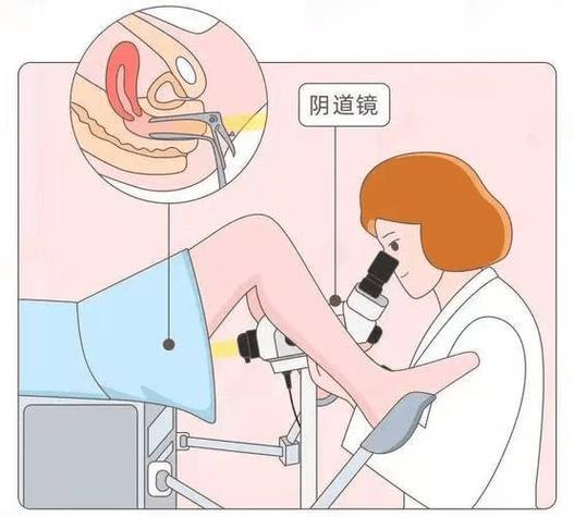 做阴道镜要提前准备什么