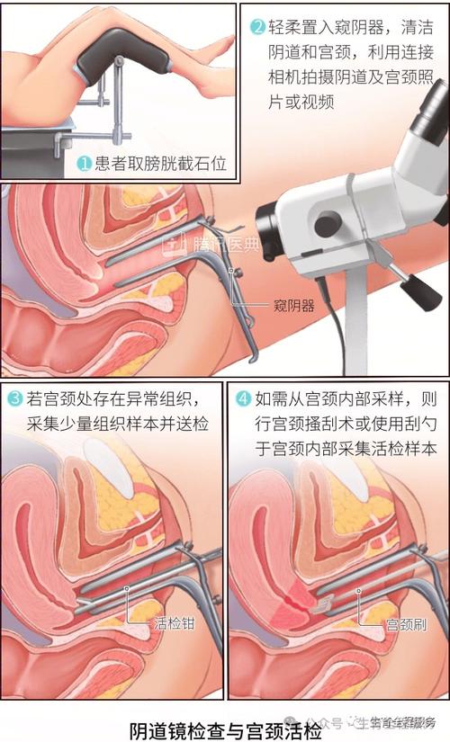 做阴道镜要提前准备什么