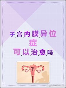子宫内膜异位症能预防吗-两性知识丨两性健康--你想了解的我都知道