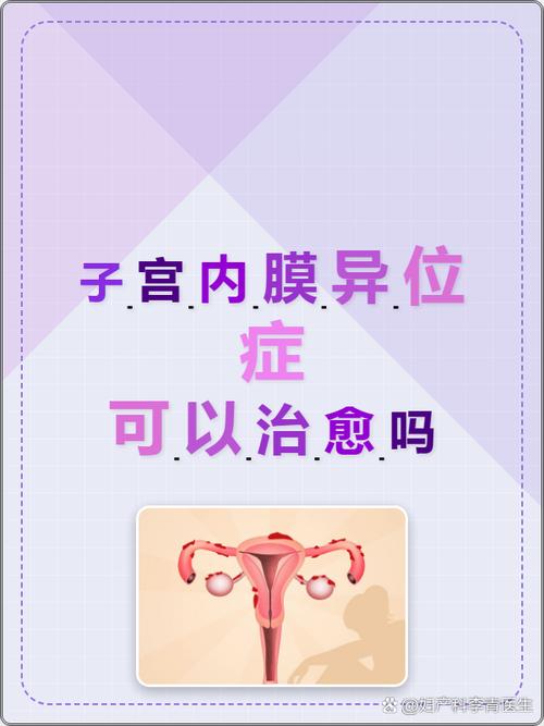 子宫内膜异位症能预防吗
