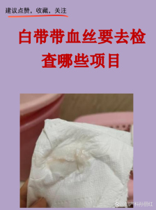 绝经后白带带血要警惕吗-两性知识丨两性健康--你想了解的我都知道