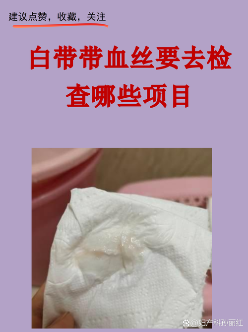 绝经后白带带血要警惕吗