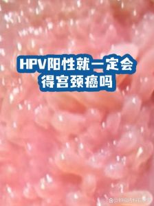 查出HPV阳性,就一定会得宫颈癌吗?-两性知识丨两性健康--你想了解的我都知道