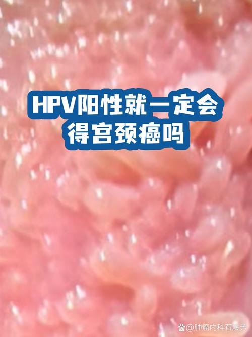 感染HPV一定会得宫颈癌吗