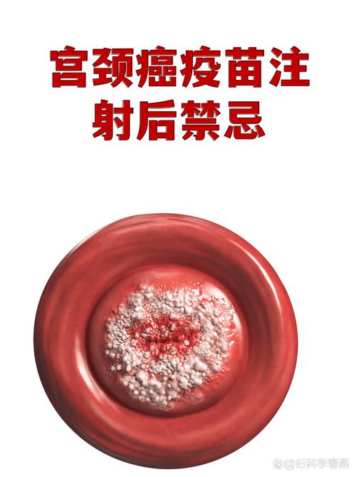 宫颈病变治疗后能打疫苗吗