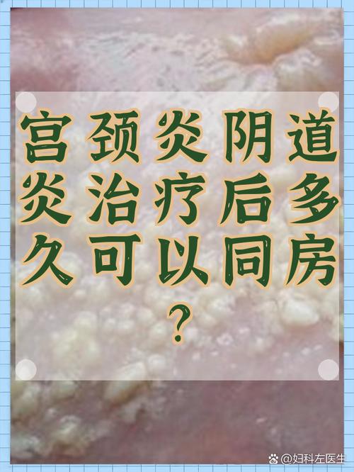 宫颈病变治疗后多久能同房