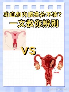子宫内膜癌和月经紊乱怎么区分？医生教你5个关键信号-两性知识丨两性健康--你想了解的我都知道