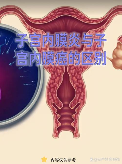 子宫内膜癌和月经紊乱怎么区分