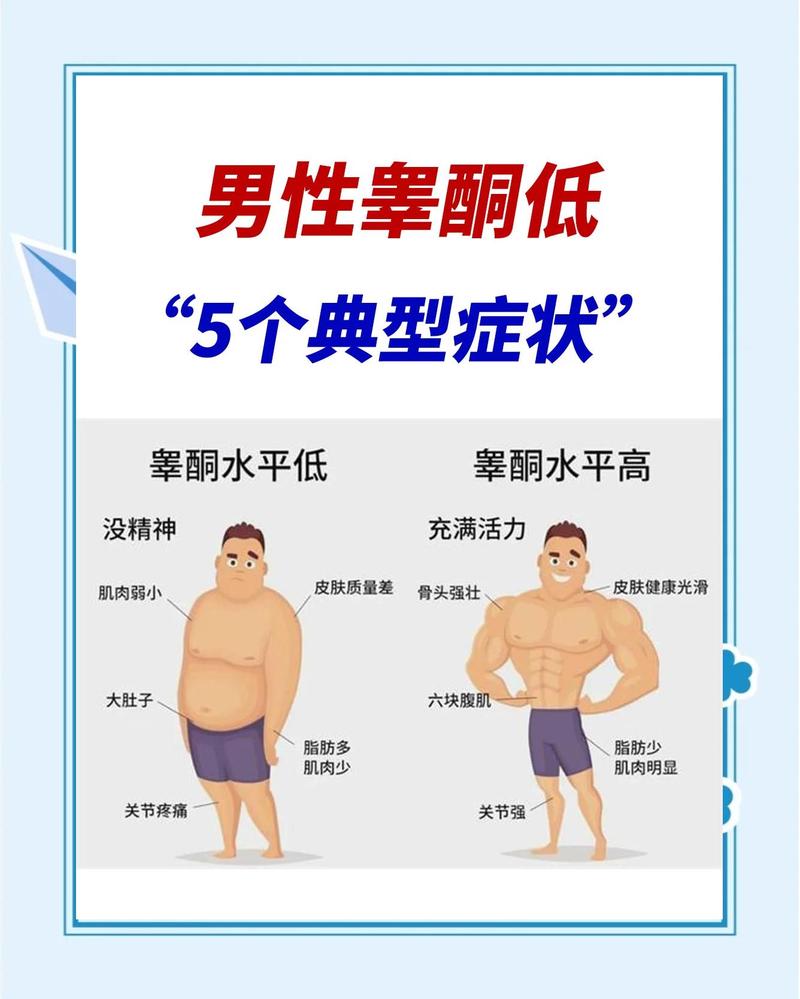 睾酮水平偏低但没症状,要治吗