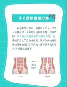 产后腹直肌分离和盆底肌到底有没有关系?-两性知识丨两性健康--你想了解的我都知道