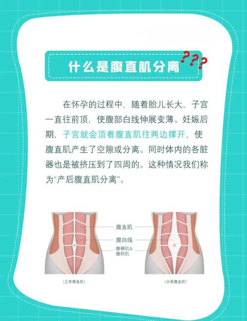 产后腹直肌分离和盆底有关吗