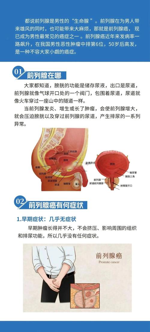 前列腺癌早期有哪些症状
