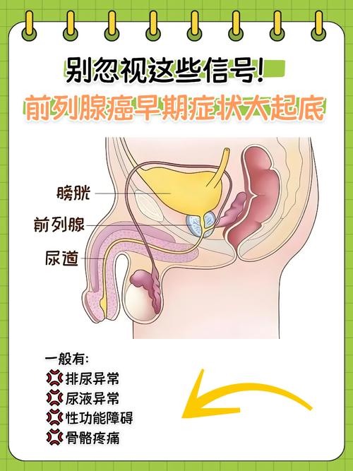 前列腺癌早期有哪些症状
