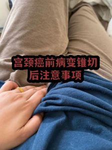 宫颈病变治疗期间需要注意哪些问题?-两性知识丨两性健康--你想了解的我都知道