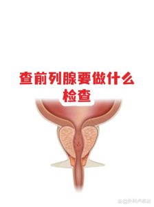 男性45岁要查前列腺吗-两性知识丨两性健康--你想了解的我都知道