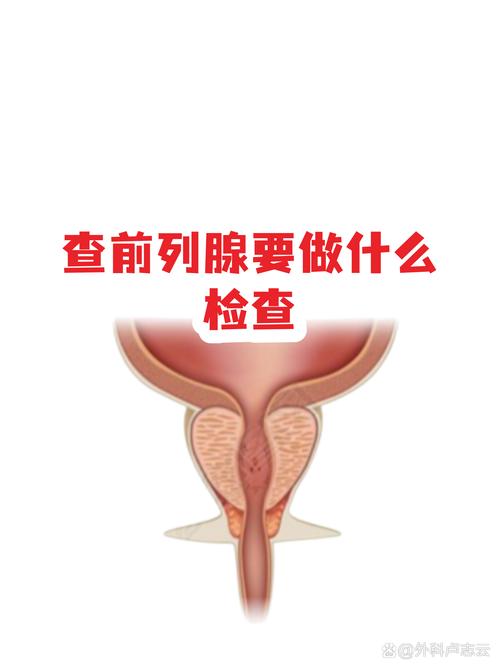 男性45岁要查前列腺吗