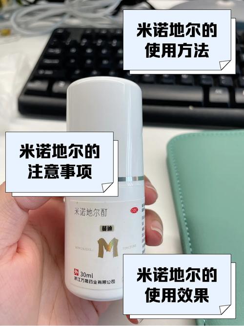 米诺地尔要一直用吗